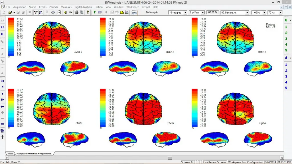 funciones del mapa cerebral