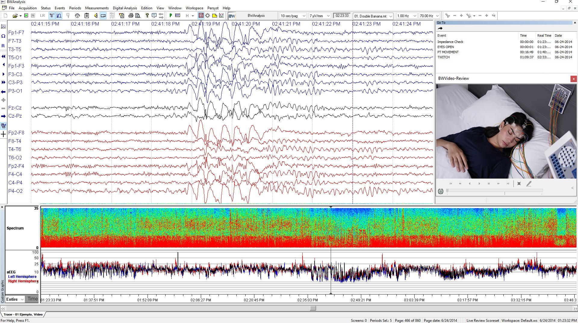 Software BWAnalysis EEG/ICU/LTM